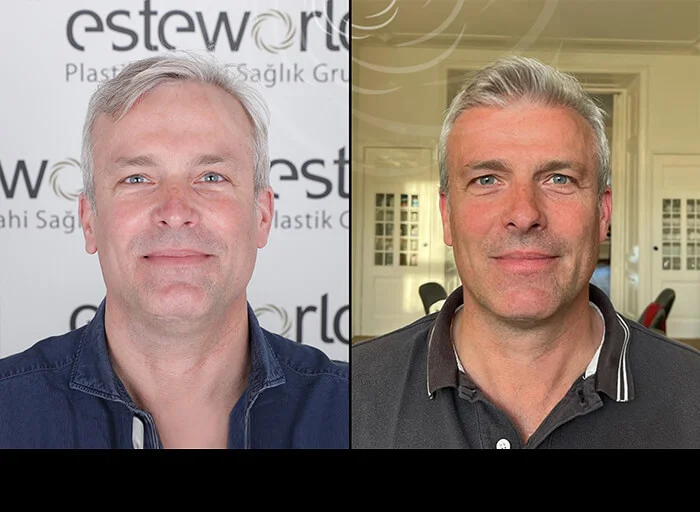 hair-before-after13.webp