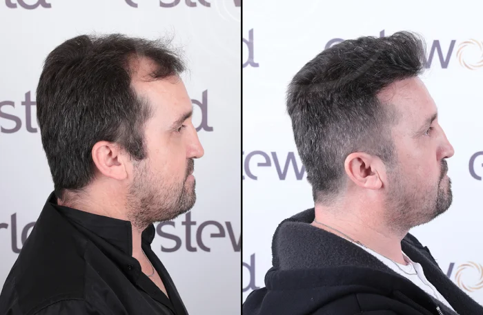 hair-before-after34.webp