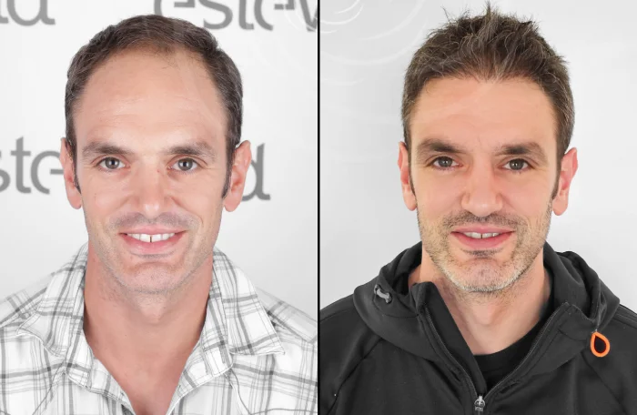 hair-before-after36.webp